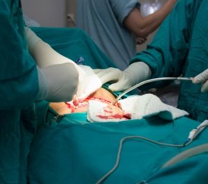 5 Crazy Medical Malpractice Court Cases - Mukerji Law