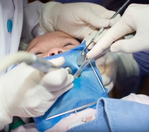 Common Bounce House Injuries: Head, Neck, Loss Of Teeth And More... - Mukerji Law