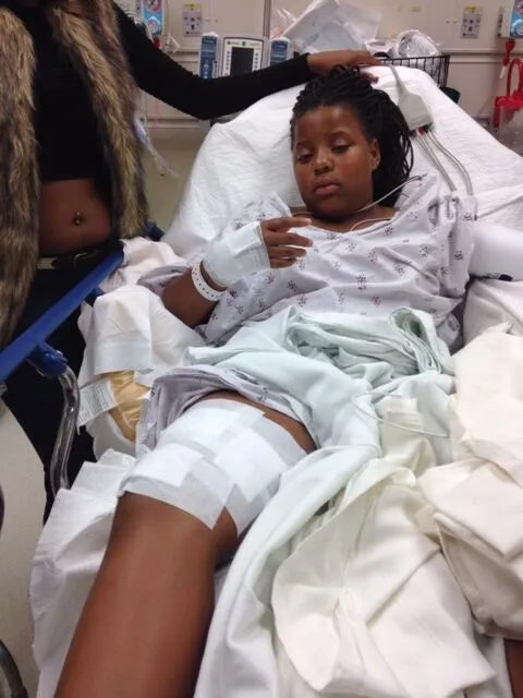 Girl Jumping On A Trampoline Crashes Through A Window - Mukerji Law