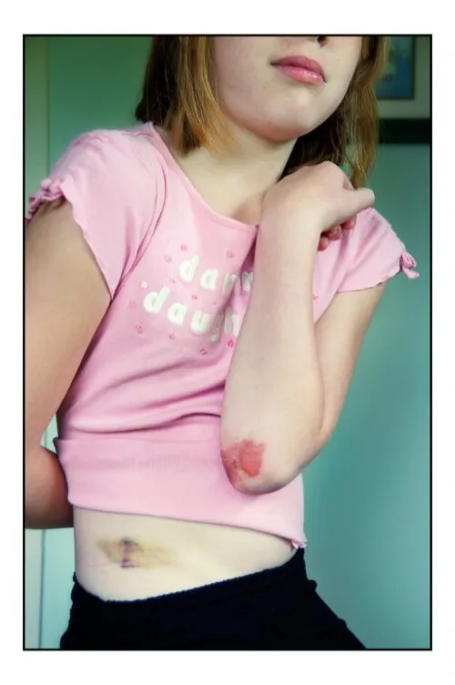 Two Children Were Injured In A Houston ISD School Bus Accident - Mukerji Law