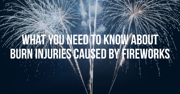 What You Need To Know About Injuries Caused By Fireworks - Mukerji Law