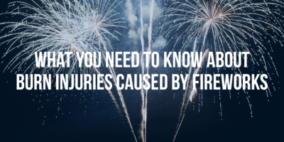 What You Need To Know About Injuries Caused By Fireworks - Mukerji Law